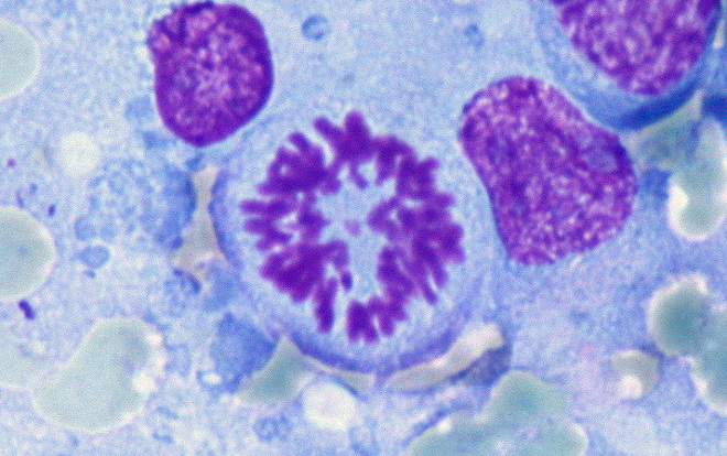 Cromosomas en una célula linfática